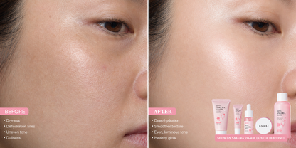 Set Soin Sakura Visage